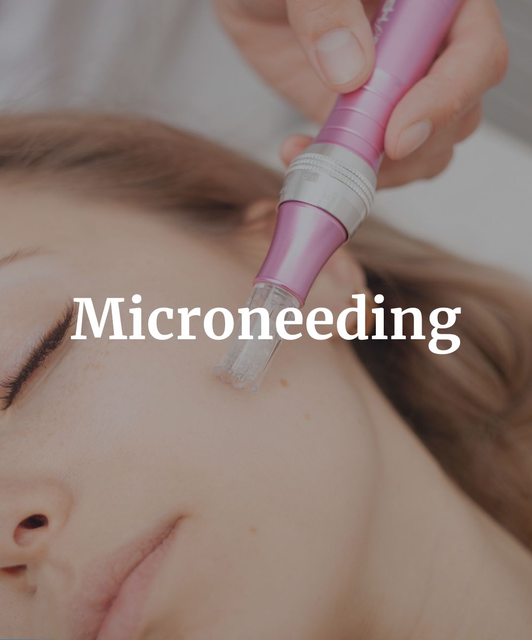 Microneedling