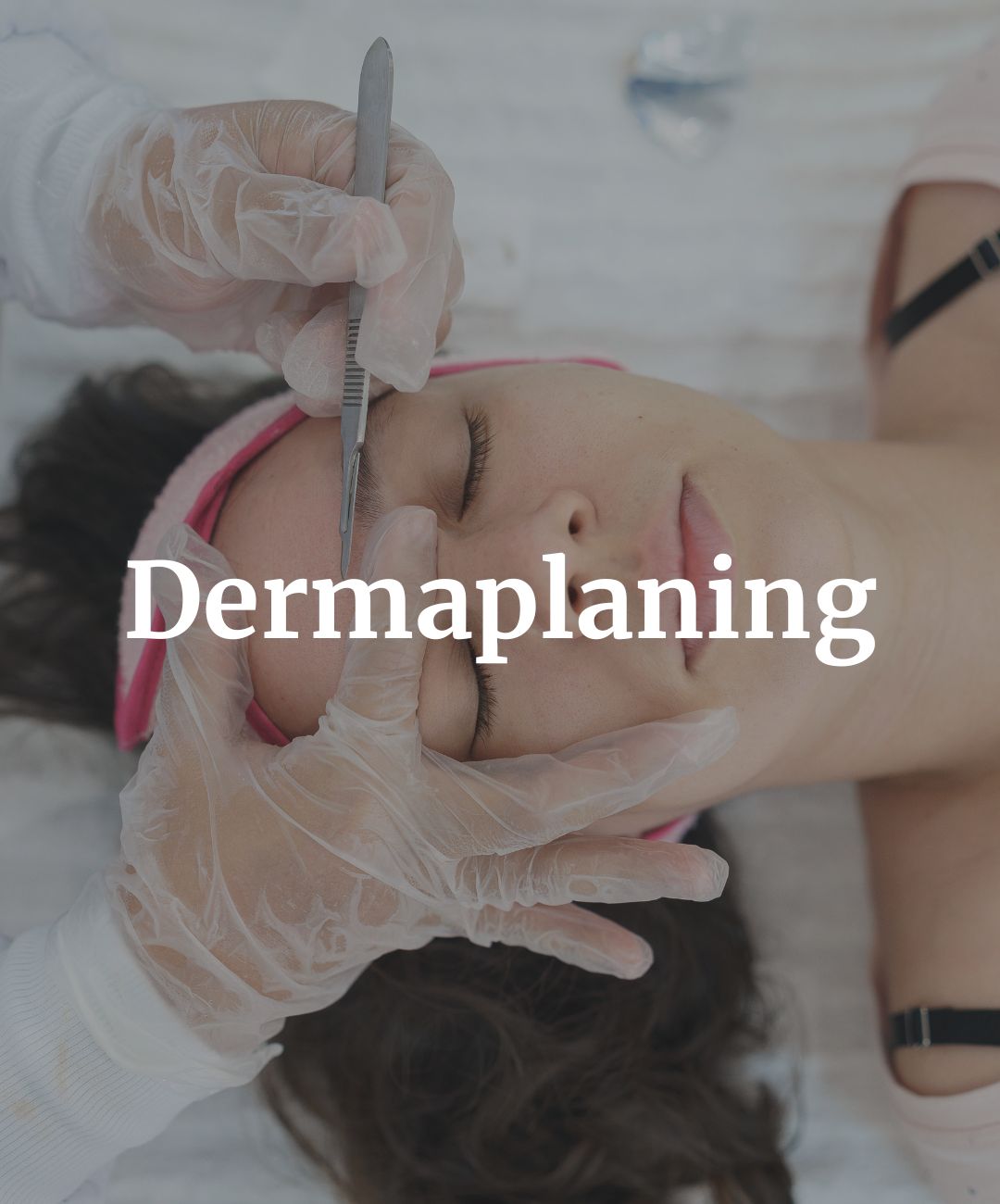 Dermaplaning